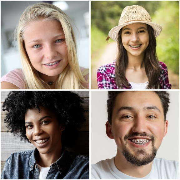 Collage of teens smiling with braces